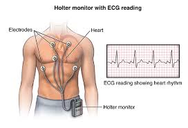 Holter Monitor Test